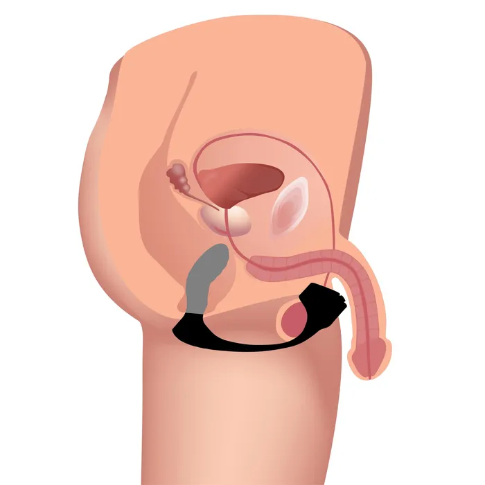 7x Silicone Prostate Plug With Ball Stretcher And Remote | XR Brands Male Sex Toys